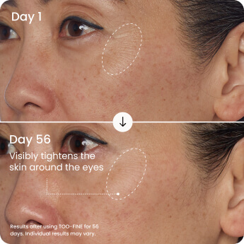 Clinically Proven to Firm Eyelids in 14 Days